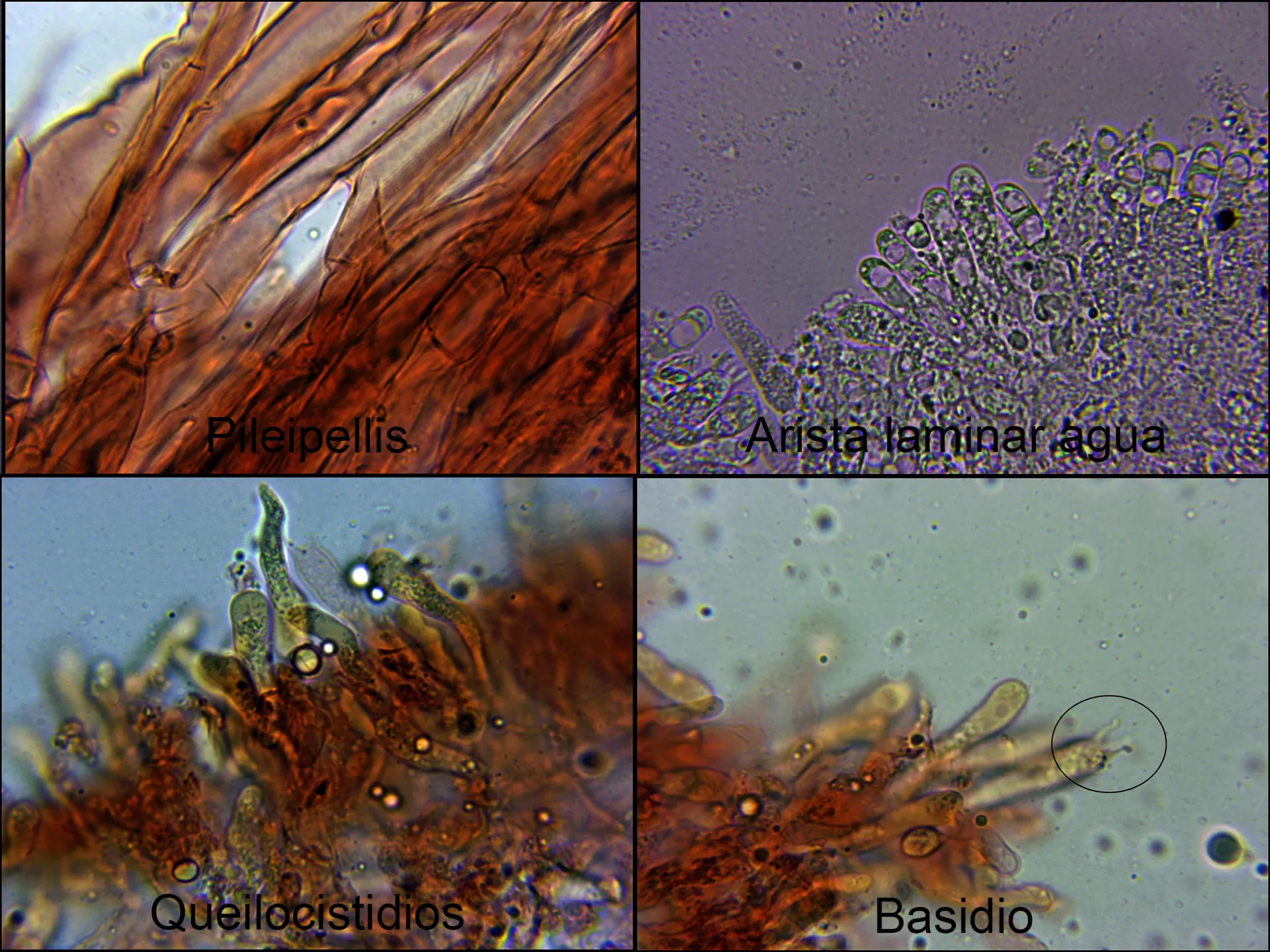 Microscopía de Phloeomana atropapillata - 5 - micro